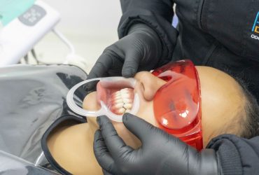 Estética dental Bucaramanga